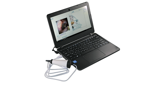 Видеоотоскоп цифровой